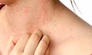 Đột phá mới trong hướng điều trị các khiếm khuyết và tai nạn về da