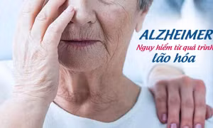 Lợi ích của caffeine trong điều trị bệnh Alzheimer