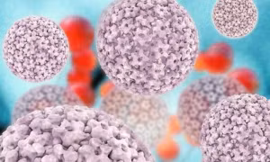 Ung thư hắc tố (melanoma) là dạng ung thư da nguy hiểm nhất. Ảnh: miragenews.com