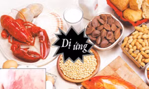 Người bị ​dị ứng thực phẩm có ít nguy cơ mắc COVID-19