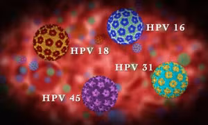 Tìm ra phương pháp điều trị tiềm năng cho các bệnh nhân nhiễm HPV