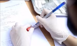 Dịch COVID-19: Thêm một ca tử vong có tiền sử viêm gan nhiễm độc