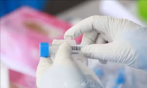 Thông tin về ca tử vong thứ 39 liên quan tới COVID-19 tại Việt Nam