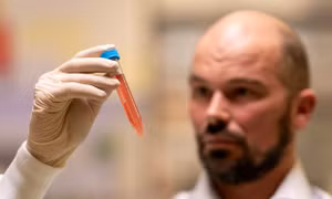 Các nhà nghiên cứu Australia phát triển hydrogel điều trị bệnh Parkinson