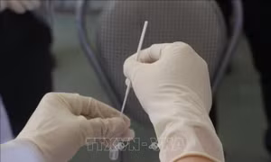 Thông tin về 2 ca tử vong do COVID-19 ở bệnh nhân có bệnh lý nền nặng