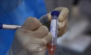 Thêm 2 ca tử vong cao tuổi, có bệnh lý nền nặng, liên quan đến COVID-19