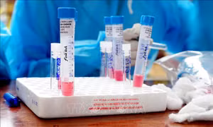 Thêm 4 ca mắc COVID-19 mới, trong đó có hai ca liên quan đến Đà Nẵng