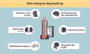Tăng huyết áp và những biến chứng nguy hiểm