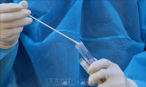 Dịch COVID-19: Tăng năng lực xét nghiệm SARS-CoV-2 thông qua phương pháp gộp mẫu
