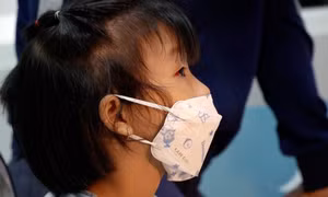 Nhiều người bị đau mắt đỏ, Sở Y tế Thành phố Hồ Chí Minh truy tìm tác nhân gây bệnh