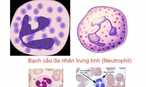 Phát hiện tế bào miễn dịch tiềm năng điều trị ung thư