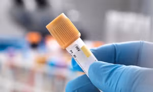 Nhờ phương pháp cấy ghép mới, một bệnh nhân nữ đầu tiên trên thế giới đã được chữa khỏi bệnh HIV. Nguồn: Getty Images