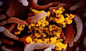 Virus corona chủng mới sinh sôi bám trên tế bào cơ thể người bị nhiễm - Ảnh: NIAID-RML
