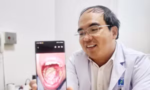 Tái tạo lưỡi cho nhiều bệnh nhân ung thư
