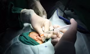 Hơn 700 trẻ em khuyết tật tỉnh Lạng Sơn được phẫu thuật miễn phí