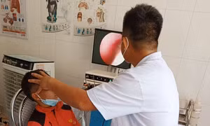 Bác sĩ Bệnh viện Đa khoa huyện Bố Trạch tiến hành nội soi và gắp thành công dị vật trong mũi của bệnh nhân. Ảnh: TTXVN phát