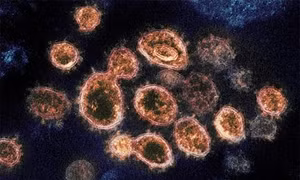 Dịch viêm đường hô hấp cấp COVID-19: Virus SARS-CoV-2 chủ yếu gây tổn thương phổi