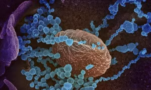 Thụy Sĩ phát triển cảm biến sinh học phát hiện virus SARS-CoV-2 trong không khí