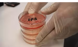 Thử nghiệm tế bào gốc iPS để chữa bệnh Parkinson