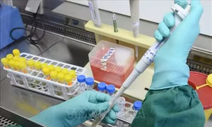 Hãng dược phẩm của Nhật Bản nộp đơn xin cấp bằng sáng chế vaccine phòng COVID-19