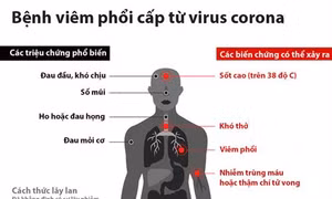 Bổ sung bệnh viêm đường hô hấp cấp do chủng mới của virus corona gây ra vào danh mục các bệnh truyền nhiễm nhóm A