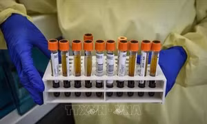 Italy thử nghiệm thành công kháng thể chống virus SARS-CoV-2 