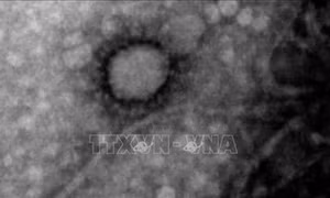 Các nhà khoa học Argentina chụp được hình ảnh virus SARS-CoV-2 ﻿