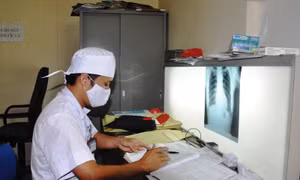 Nghiên cứu bệnh án điều trị cho bệnh nhân lao tại Trung tâm Y tế huyện Ba Bể (Bắc Kạn). Ảnh: baobackan.vn