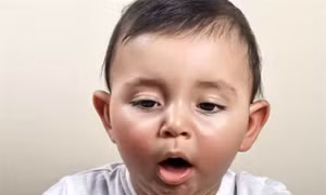 Xử trí tại chỗ dị vật đường thở cho trẻ
