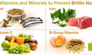 4 loại vitamin và khoáng chất ngăn ngừa móng tay giòn và dễ gãy