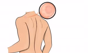 10 dấu hiệu cơ thể cho biết bạn đang bị căng thẳng