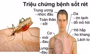 Nghiên cứu phương thức mới tiêu diệt mầm bệnh sốt rét trong gan