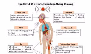 Những di chứng hậu COVID-19. Ảnh: benhviendakhoatinhphutho.vn