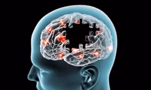 Phát hiện gene, cần thiết cho sự phát triển, của não bộ. Ảnh : tuoi tre.vn 