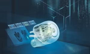 Ảnh minh họa.(Nguồn: Siemens)