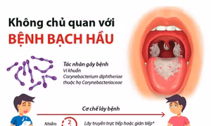 Không chủ quan với bệnh bạch hầu.Ảnh: Cục y tế dự phòng.