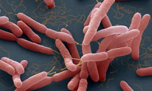Vi khuẩn Burkholderia pseudomallei gây bệnh Whitmore. Nguồn: benhvien108.vn