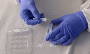 Bộ xét nghiệm nhanh COVID-19 của công ty Anh cho kết quả chính xác cao với biến thể Omicron