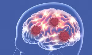 Virus SARS-CoV-2 tấn công vào não bộ con người. Ảnh: promegaconnections.com