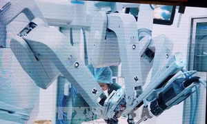 Thêm một bệnh viện sử dụng robot trong phẫu thuật ung thư