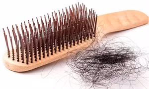9 dấu hiệu cảnh báo sức khỏe của bạn đang "xuống cấp"