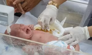 Phẫu thuật lấy khối bướu hiếm gặp ở trẻ sơ sinh