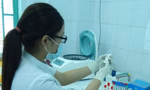 Việt Nam chưa ghi nhận trường hợp xét nghiệm dương tính với vi rút Zika