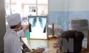 Bước đột phá trong điều trị lao kháng thuốc