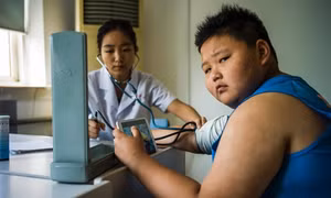 Thừa cân, béo phì làm giảm từ 1 đến 10 năm tuổi thọ