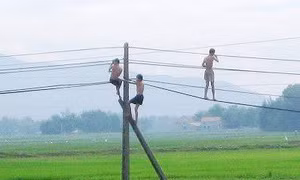 Hai em nhỏ bị thương trong vụ tai nạn điện giật ở Chiềng Khoong đã ổn định sức khỏe