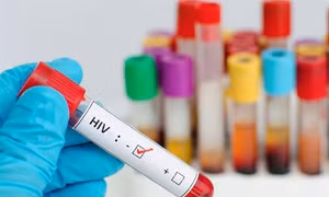 Nam Phi ra mắt thuốc điều trị HIV/AIDS hiệu quả cao