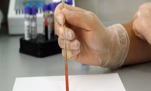 Phát minh thiết bị phát hiện vi khuẩn chỉ trong ít phút