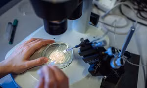 Thử nghiệm công nghệ chỉnh sửa gen CRISPR trong điều trị ung thư