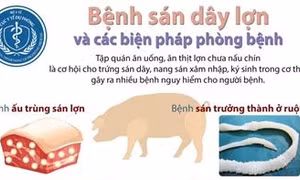 Bệnh sán dây lợn và biện pháp phòng chống